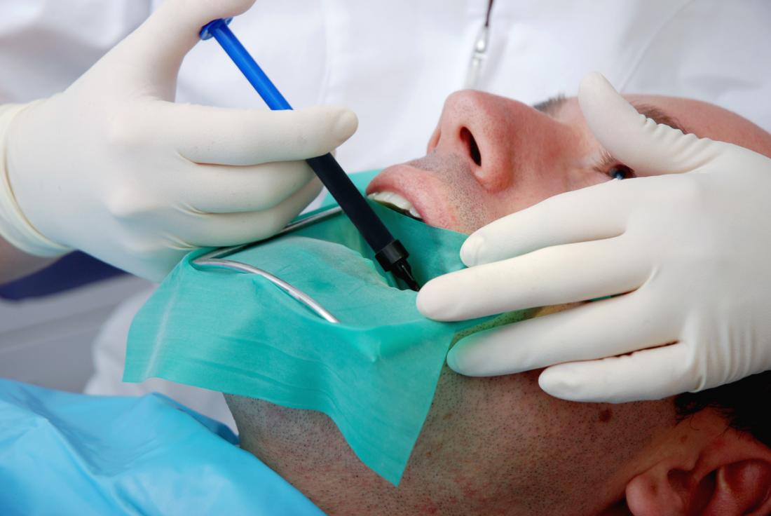 Laser-Assisted Endodontic Treatment: Revolutionizing Root Canal Therapy