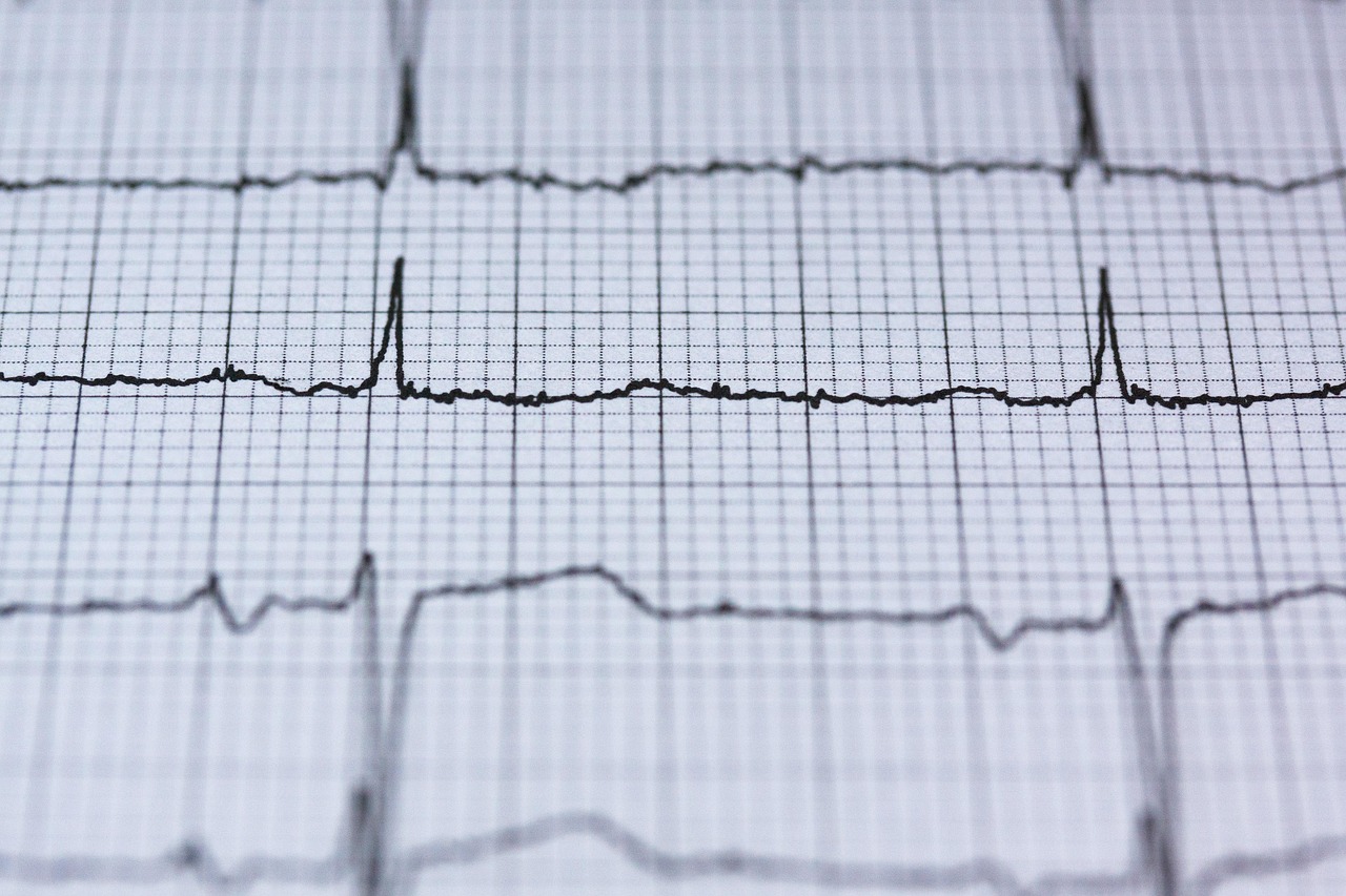 Ecg, electrocardiogram, medicine — The Role of HHC Vape in Appetite Stimulation: Insights and Benefits