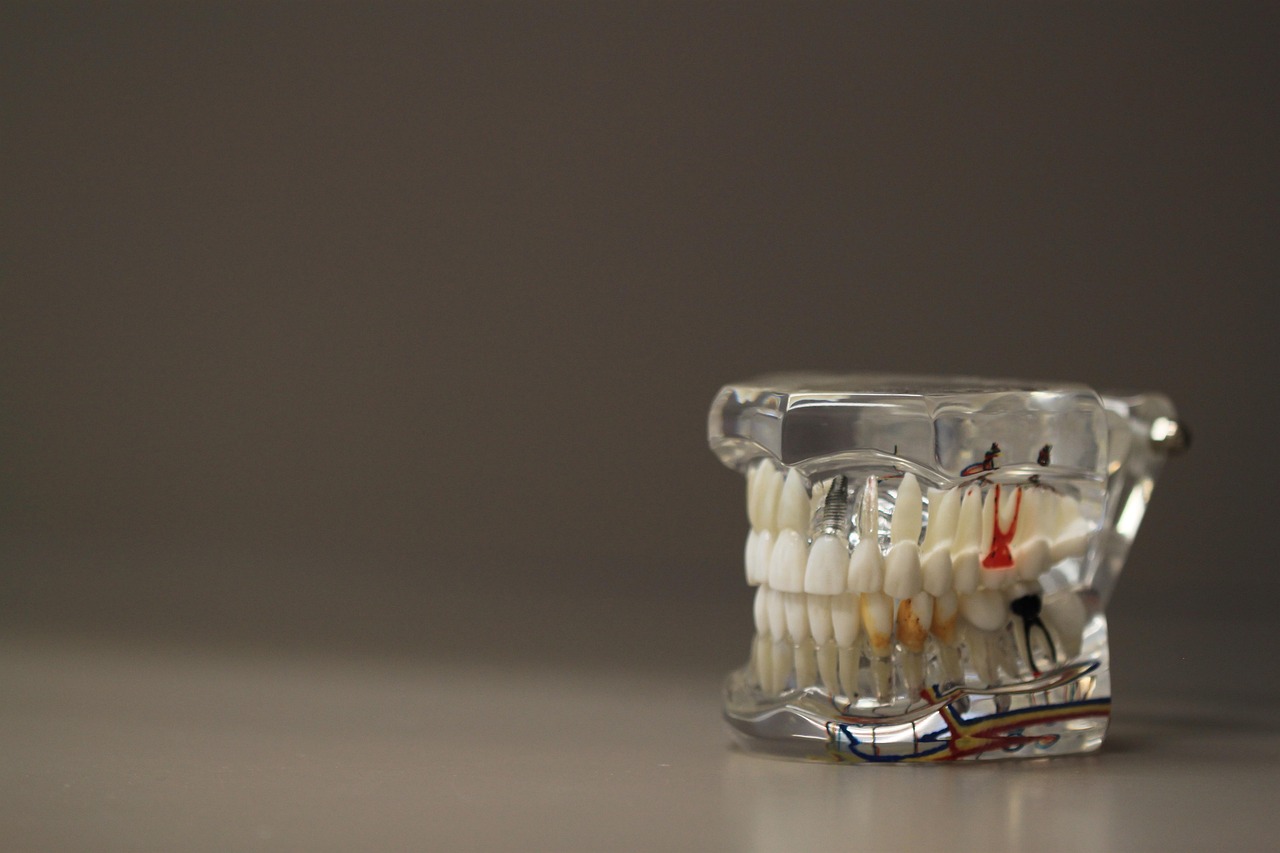Dentistry, dentals, teeth — Understanding the Science Behind How Invisalign Works to Straighten Your Smile